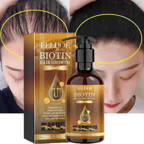 Biotin Fast Hair Growth Shampoo Anti Hair Loss Serum Scalp Treatment Prevent Alopecia Baldness Conditioner Hair Care Products