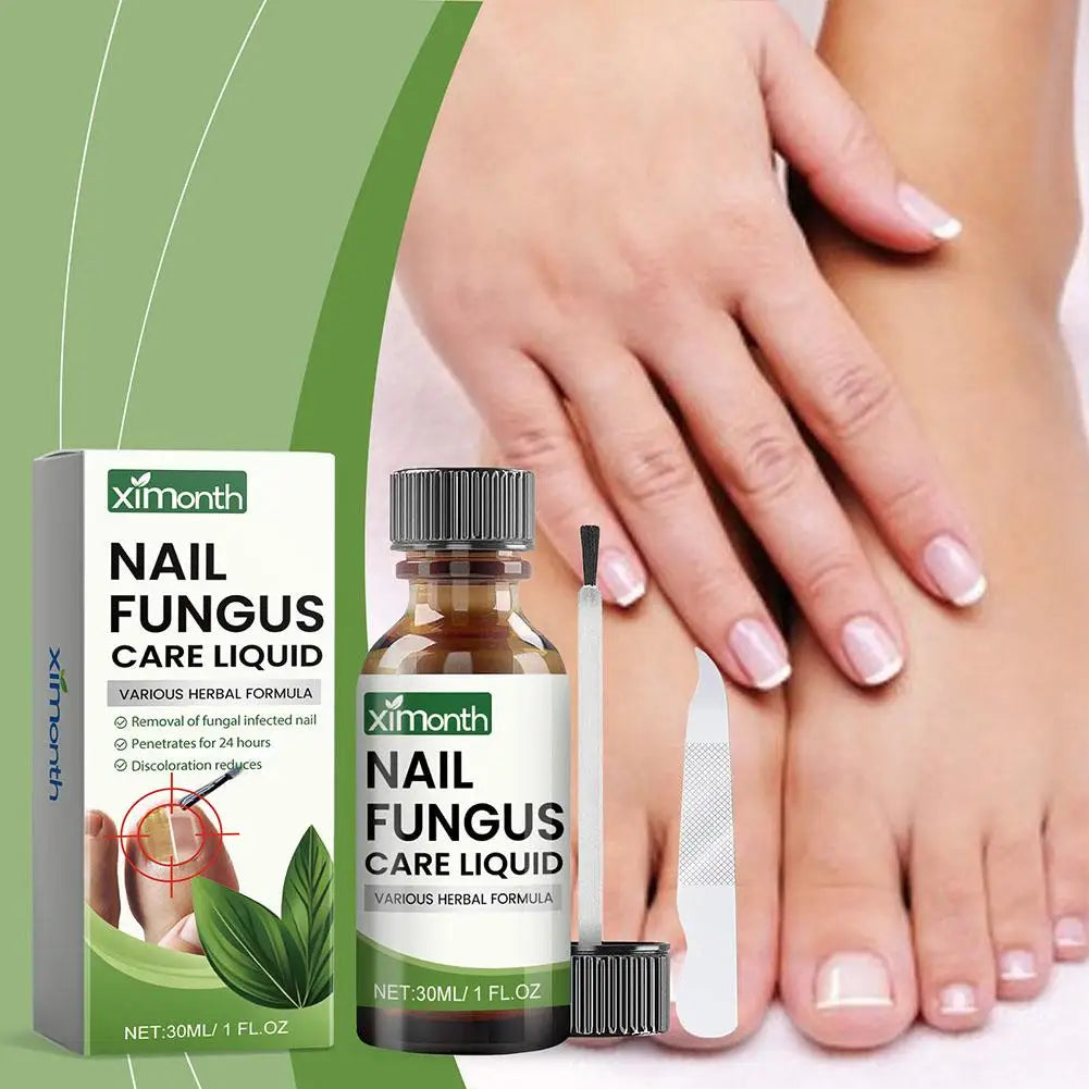 Onychomycosis Hand Foot Removal Repair Care Nail Fungal Treatment Serum Anti Infection Toe Fungus Paronychia 50g